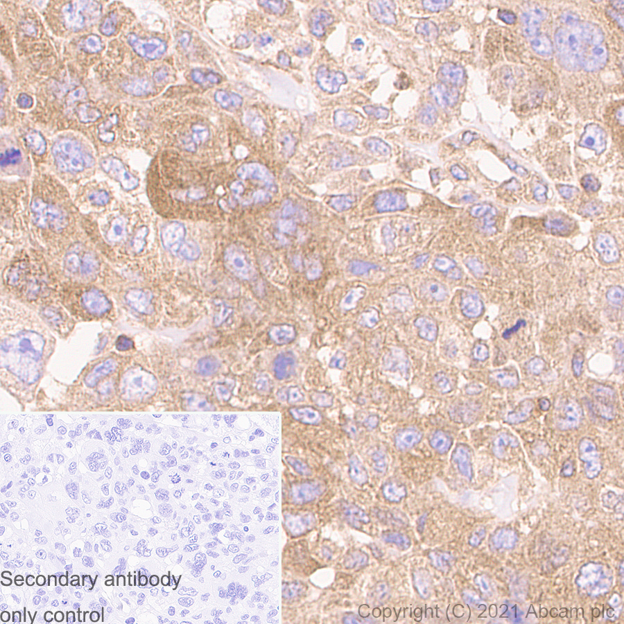 Immunohistochemistry (Formalin/PFA-fixed paraffin-embedded sections) - Anti-ROCK1 antibody [EPR638Y] - BSA and Azide free (AB230799), expandable thumbnail