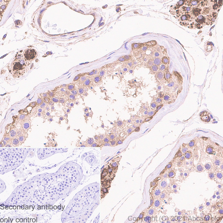 Immunohistochemistry (Formalin/PFA-fixed paraffin-embedded sections) - Anti-ROCK1 antibody [EPR638Y] - BSA and Azide free (ab230799), expandable thumbnail