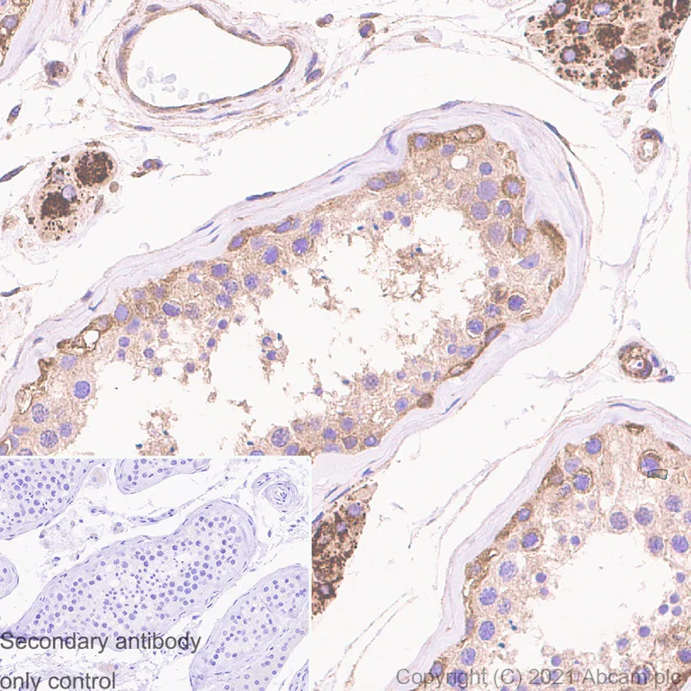 Immunohistochemistry (Formalin/PFA-fixed paraffin-embedded sections) - Anti-ROCK1 antibody [EPR638Y] - BSA and Azide free (AB230799)