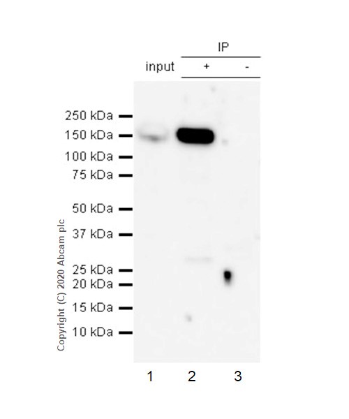 Immunoprecipitation - Anti-ROCK1 antibody [EPR638Y] - BSA and Azide free (AB230799), expandable thumbnail