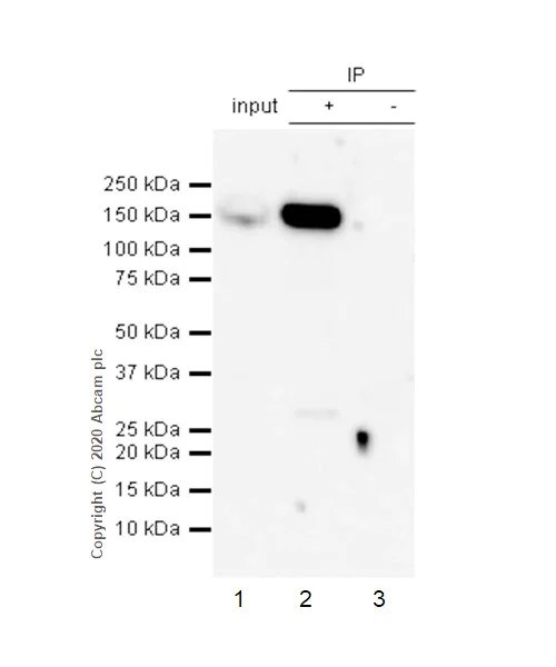 Immunoprecipitation - Anti-ROCK1 antibody [EPR638Y] - BSA and Azide free (AB230799)