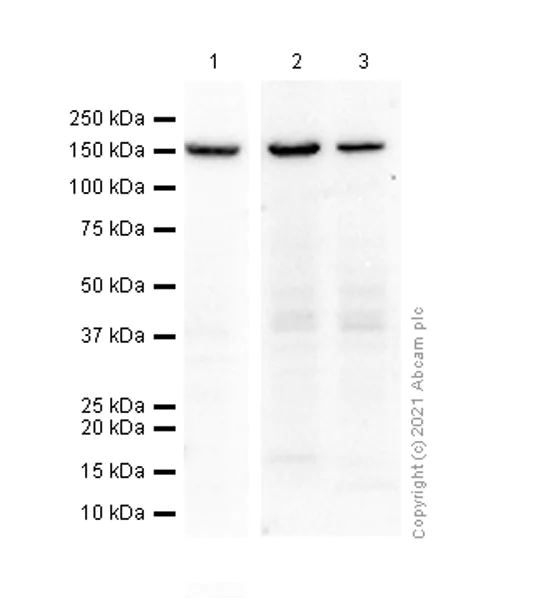 Western blot - Anti-ROCK1 antibody [EPR638Y] - BSA and Azide free (AB230799)