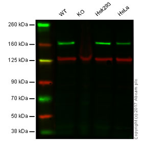 Western blot - Anti-ROCK1 antibody [EPR638Y] - BSA and Azide free (AB230799), expandable thumbnail