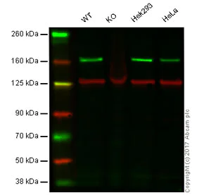 Western blot - Anti-ROCK1 antibody [EPR638Y] - BSA and Azide free (AB230799)