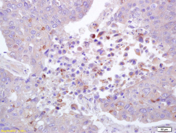 Immunohistochemistry (Formalin/PFA-fixed paraffin-embedded sections) - Anti-ROCK1 (phospho T455 + S456) antibody (AB203273)
