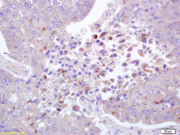 Immunohistochemistry (Formalin/PFA-fixed paraffin-embedded sections) - Anti-ROCK1 (phospho T455 + S456) antibody (AB203273)