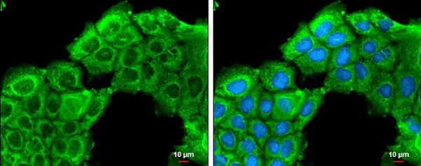 Immunocytochemistry/ Immunofluorescence - Anti-ROCK2 antibody - C-terminal (AB228000)