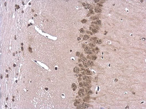 Immunohistochemistry (Formalin/PFA-fixed paraffin-embedded sections) - Anti-ROCK2 antibody - C-terminal (AB228000)