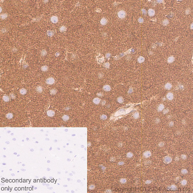 Immunohistochemistry (Formalin/PFA-fixed paraffin-embedded sections) - Anti-ROCK2 antibody [EPR24575-76] (AB317246)