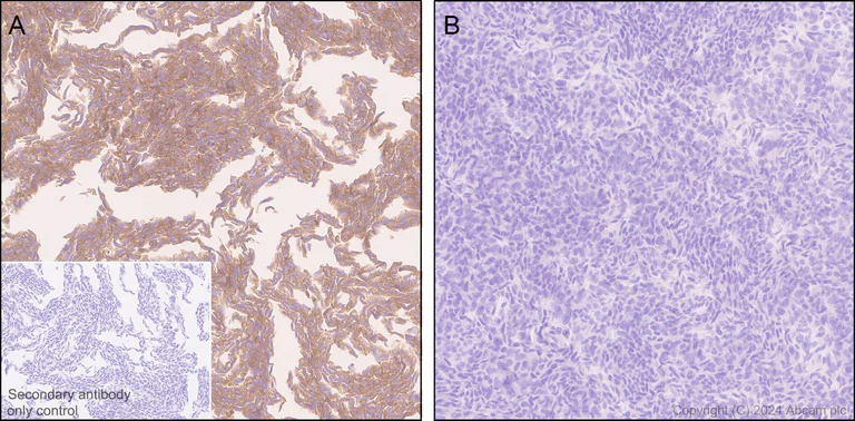 Immunohistochemistry (Formalin/PFA-fixed paraffin-embedded sections) - Anti-ROCK2 antibody [EPR24575-76] (AB317246)