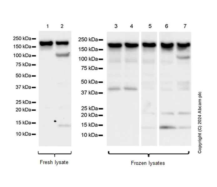 Western blot - Anti-ROCK2 antibody [EPR24575-76] (AB317246)