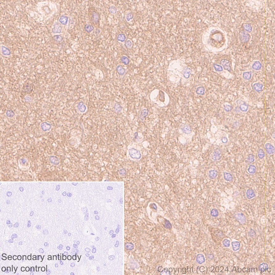 Immunohistochemistry (Formalin/PFA-fixed paraffin-embedded sections) - Anti-ROCK2 antibody [EPR24575-76] - BSA and Azide free (ab317247), expandable thumbnail