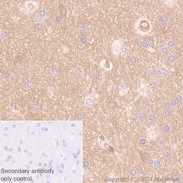 Immunohistochemistry (Formalin/PFA-fixed paraffin-embedded sections) - Anti-ROCK2 antibody [EPR24575-76] - BSA and Azide free (AB317247)