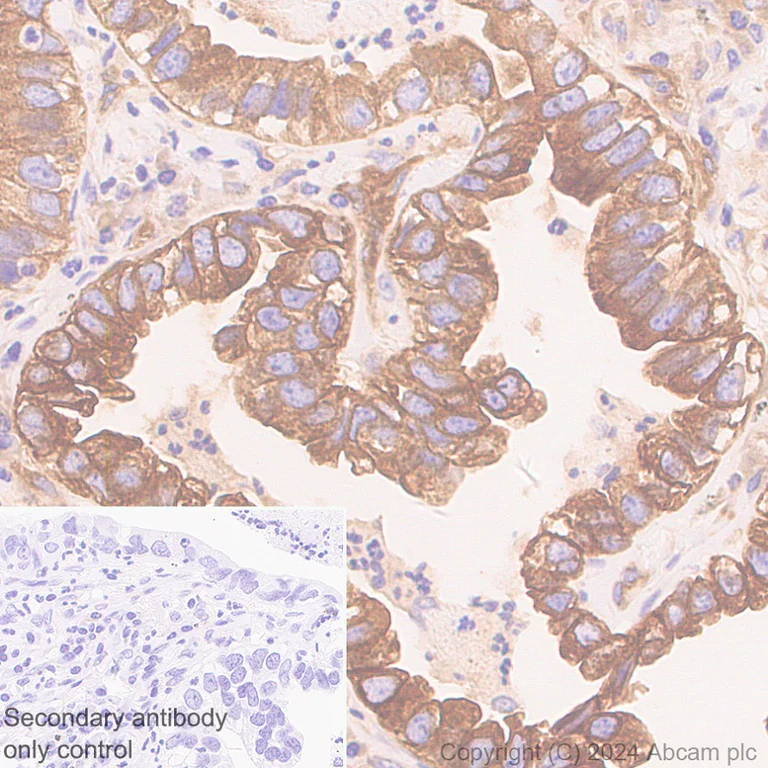 Immunohistochemistry (Formalin/PFA-fixed paraffin-embedded sections) - Anti-ROCK2 antibody [EPR24575-76] - BSA and Azide free (AB317247)