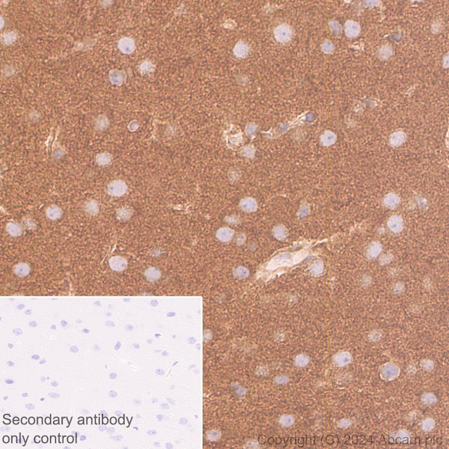 Immunohistochemistry (Formalin/PFA-fixed paraffin-embedded sections) - Anti-ROCK2 antibody [EPR24575-76] - BSA and Azide free (AB317247), expandable thumbnail