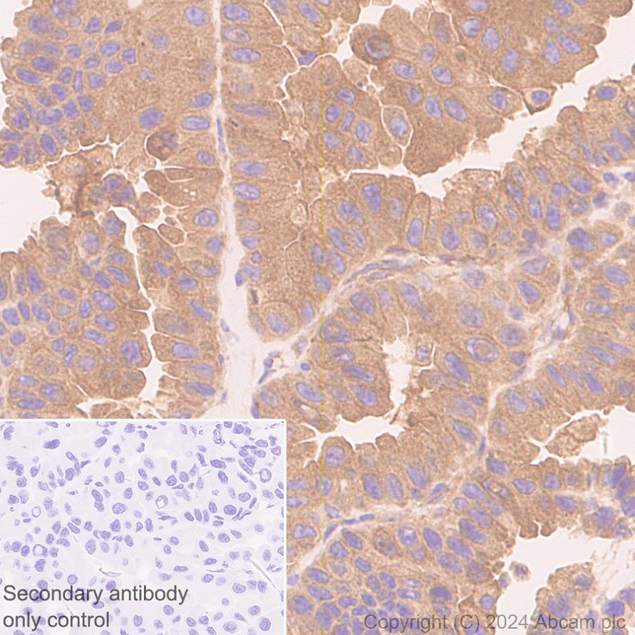 Immunohistochemistry (Formalin/PFA-fixed paraffin-embedded sections) - Anti-ROCK2 antibody [EPR24575-76] - BSA and Azide free (AB317247), expandable thumbnail