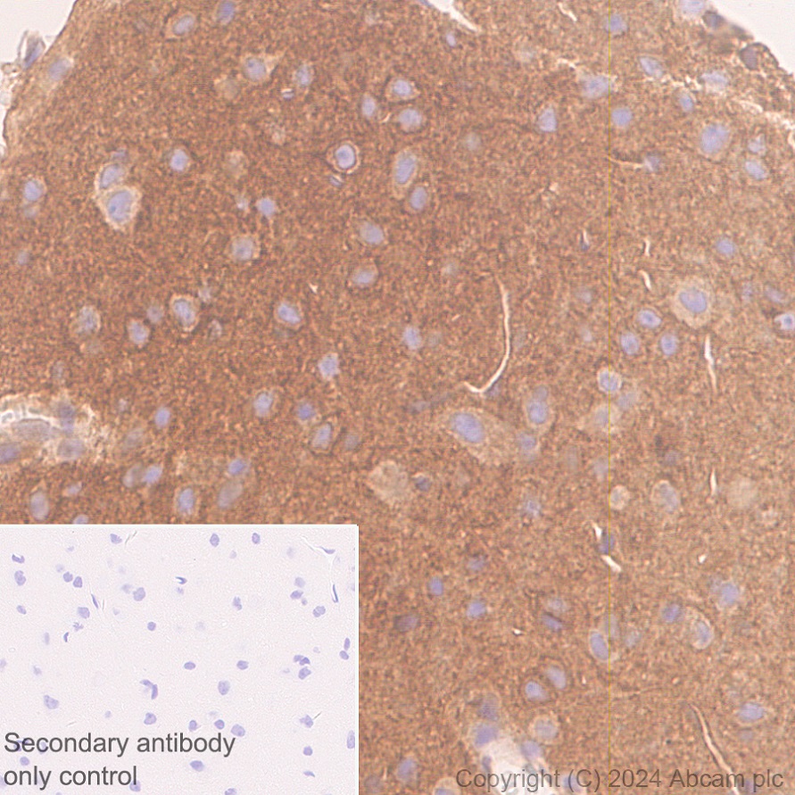 Immunohistochemistry (Formalin/PFA-fixed paraffin-embedded sections) - Anti-ROCK2 antibody [EPR24575-76] - BSA and Azide free (AB317247), expandable thumbnail