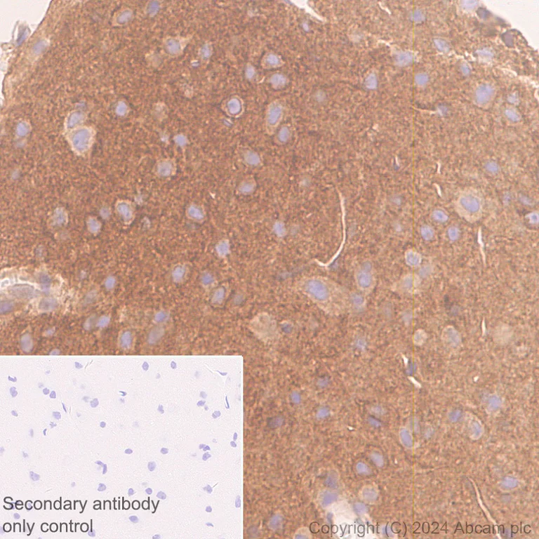 Immunohistochemistry (Formalin/PFA-fixed paraffin-embedded sections) - Anti-ROCK2 antibody [EPR24575-76] - BSA and Azide free (AB317247)