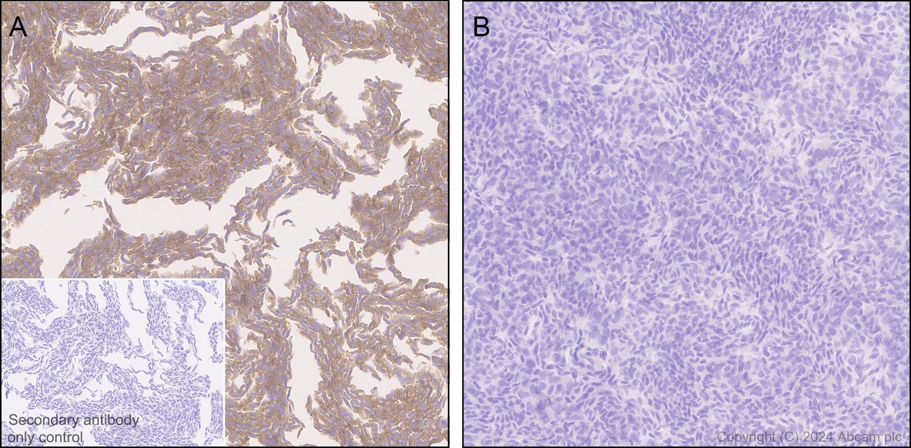 Immunohistochemistry (Formalin/PFA-fixed paraffin-embedded sections) - Anti-ROCK2 antibody [EPR24575-76] - BSA and Azide free (AB317247), expandable thumbnail