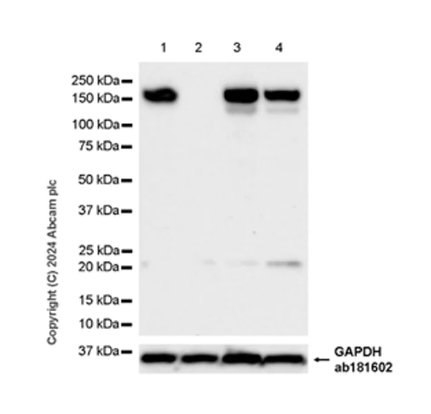 Western blot - Anti-ROCK2 antibody [EPR24575-76] - BSA and Azide free (AB317247)