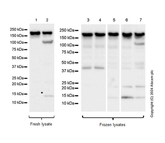 Western blot - Anti-ROCK2 antibody [EPR24575-76] - BSA and Azide free (ab317247), expandable thumbnail