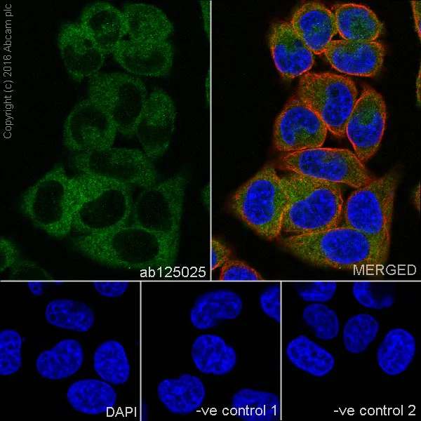 Immunocytochemistry/ Immunofluorescence - Anti-ROCK2 antibody [EPR7141(B)] (AB125025)