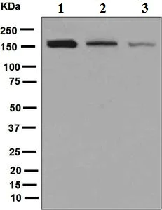 Western blot - Anti-ROCK2 antibody [EPR7141(B)] (AB125025)