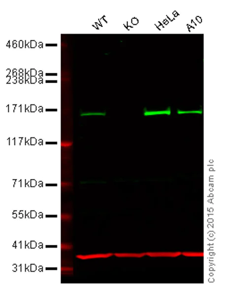 Western blot - Anti-ROCK2 antibody [EPR7141(B)] (AB125025)