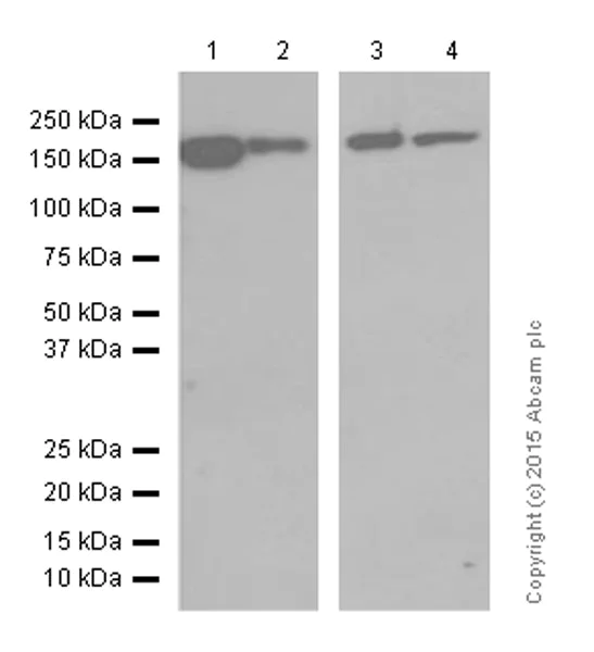 Western blot - Anti-ROCK2 antibody [EPR7141(B)] (AB125025)