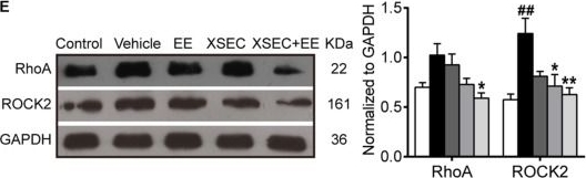 Anti-ROCK2 antibody [EPR7141(B)]