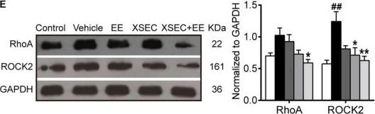 Western blot - Anti-ROCK2 antibody [EPR7141(B)] (AB125025)