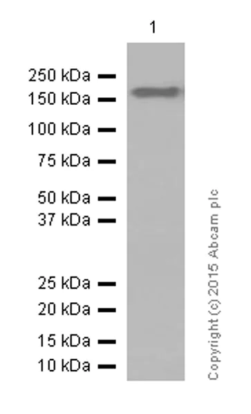 Western blot - Anti-ROCK2 antibody [EPR7141(B)] (AB125025)