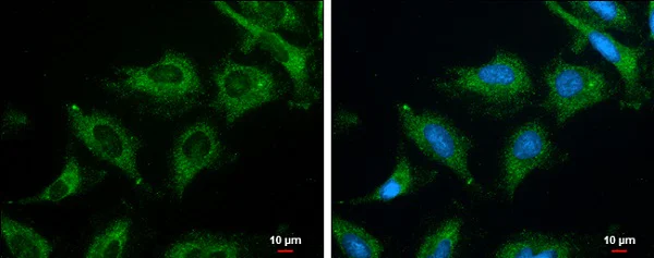 Immunocytochemistry/ Immunofluorescence - Anti-ROCK2 (phospho S1366) antibody (AB228008)