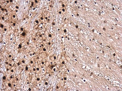Immunohistochemistry (Formalin/PFA-fixed paraffin-embedded sections) - Anti-ROCK2 (phospho S1366) antibody (AB228008)