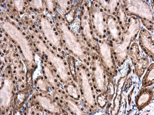 Immunohistochemistry (Formalin/PFA-fixed paraffin-embedded sections) - Anti-ROCK2 (phospho S1366) antibody (AB228008)