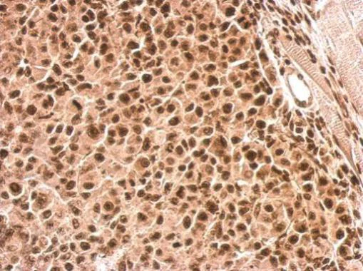 Immunohistochemistry (Formalin/PFA-fixed paraffin-embedded sections) - Anti-ROCK2 (phospho S1366) antibody (AB228008)