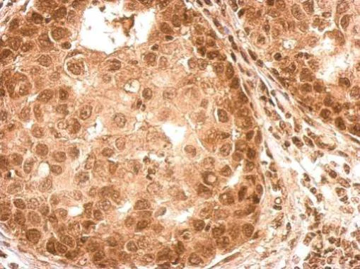 Immunohistochemistry (Formalin/PFA-fixed paraffin-embedded sections) - Anti-ROCK2 (phospho S1366) antibody (AB228008)