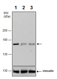 Western blot - Anti-ROCK2 (phospho S1366) antibody (AB228008)