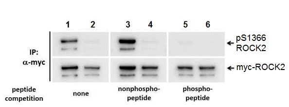 Western blot - Anti-ROCK2 (phospho S1366) antibody (AB228008)