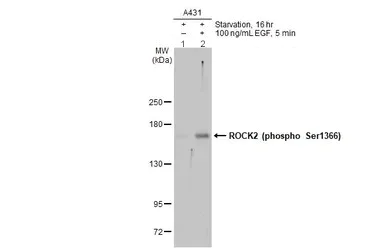 Western blot - Anti-ROCK2 (phospho S1366) antibody (AB228008)