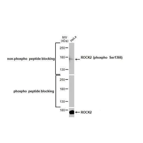 Western blot - Anti-ROCK2 (phospho S1366) antibody [HL1071] (AB317080)