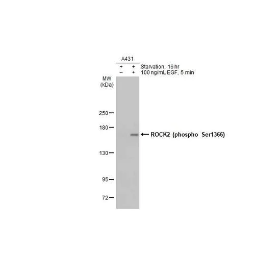 Western blot - Anti-ROCK2 (phospho S1366) antibody [HL1071] (AB317080)