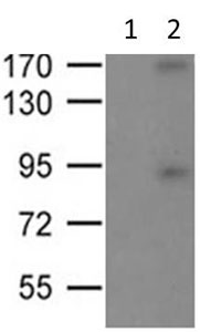 Western blot - Anti-ROCK2 (phospho Y722) antibody (AB182648)