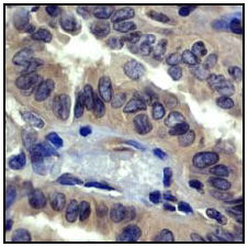Immunohistochemistry (Formalin/PFA-fixed paraffin-embedded sections) - Anti-ROCK2 + ROCK1 antibody [EP786Y] (ab45171), expandable thumbnail