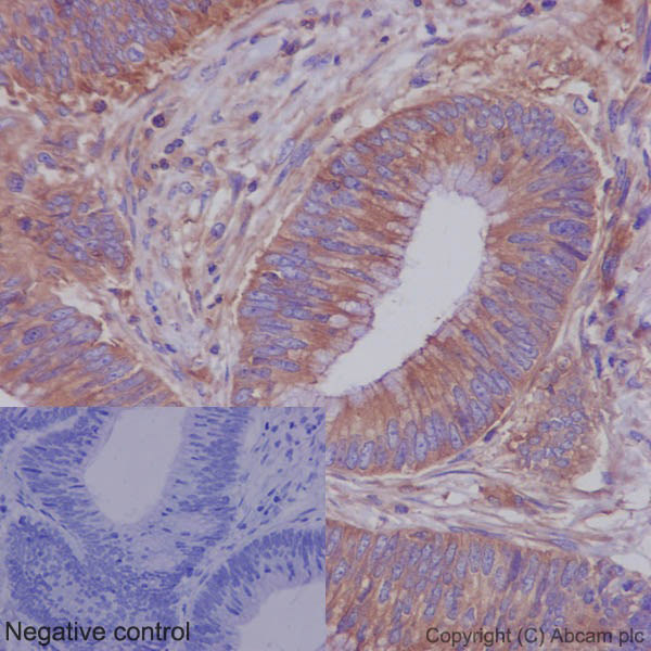 Immunohistochemistry (Formalin/PFA-fixed paraffin-embedded sections) - Anti-ROCK2 + ROCK1 antibody [EP786Y] (AB45171), expandable thumbnail
