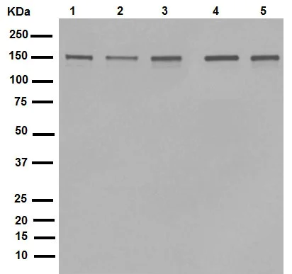 Western blot - Anti-ROCK2 + ROCK1 antibody [EP786Y] (AB45171)
