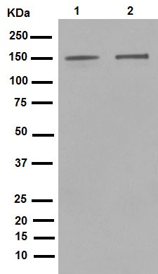 Western blot - Anti-ROCK2 + ROCK1 antibody [EP786Y] (ab45171), expandable thumbnail