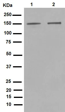 Western blot - Anti-ROCK2 + ROCK1 antibody [EP786Y] (AB45171)