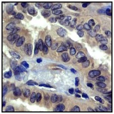 Immunohistochemistry (Formalin/PFA-fixed paraffin-embedded sections) - Anti-ROCK2 + ROCK1 antibody [EP786Y] - BSA and Azide free (AB219587)