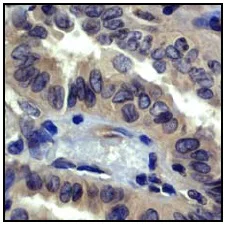 Immunohistochemistry (Formalin/PFA-fixed paraffin-embedded sections) - Anti-ROCK2 + ROCK1 antibody [EP786Y] - BSA and Azide free (AB219587)